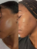 Dark Spot Correcting & Radiance Booster Routine – 3-Step Bundle