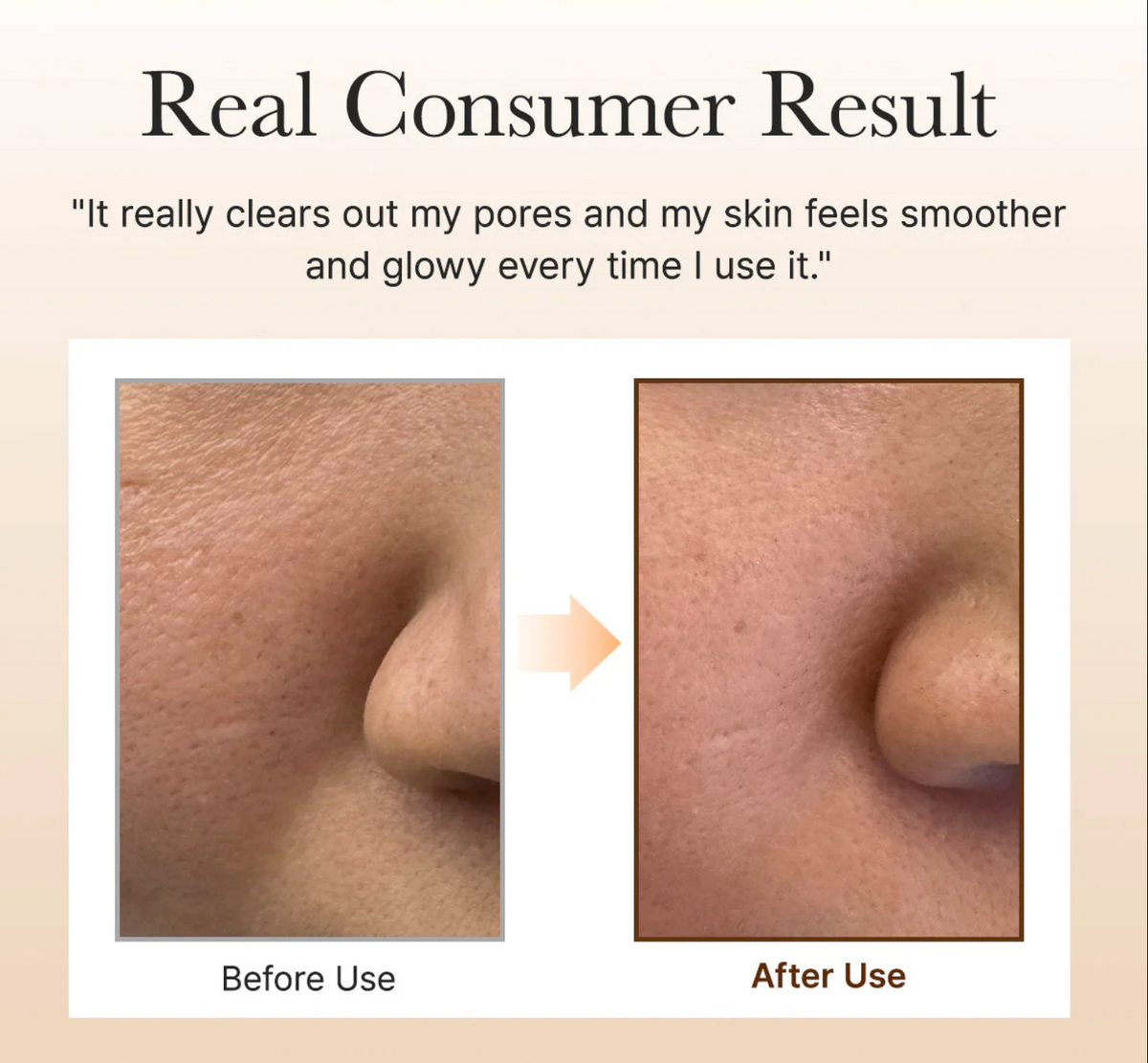 Before and after skin treatment showing smoother skin texture on a beige background.