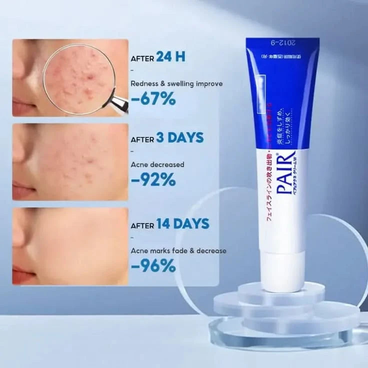 LION Pair Acne Cream W - Japan's #1 Pimple Treatment (Non-Drying & Invisible)
