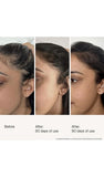 BEYOND Healing Force Scalp Clinic Serum - Best for Hair Fall & Weak Roots (Professional Care)