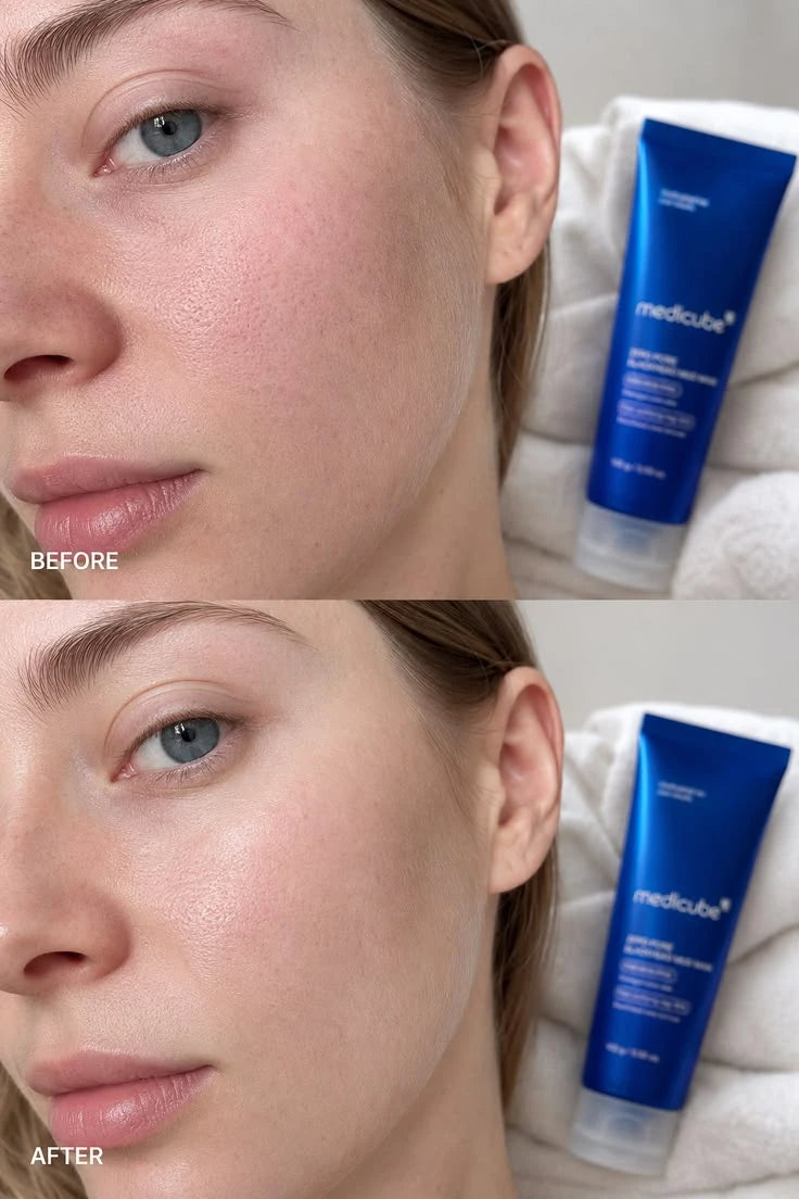 Medicube - Zero Pore Blackhead Mud Mask