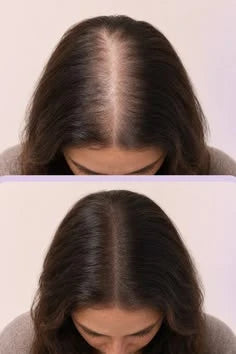 AROMATICA Rosemary Hair Thickening Conditioner - Best for Hair Fall & Damage Repair (Silicone-Free)
