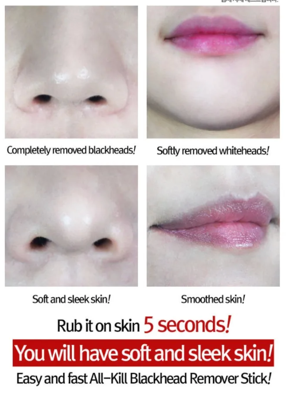 RiRe - All Kill Blackhead Remover Stick 10g