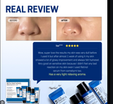 SOME BY MI - Beta Panthenol Repair Starter Kit