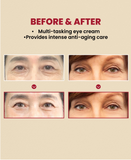 KSECRET - SEOUL 1988 Eye Cream : Retinal Liposome 4% + Fermented Bean