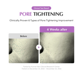 EQQUALBERRY Purple PDRN Pore Minimizing Serum – Vegan Collagen & Peptides for Pore Refining & Skin Elasticity | Niacinamide & CICA Exosome for Calming | Korean Glass Skin